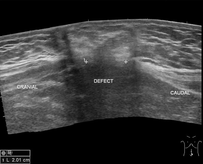 Image Radiopaedia Org