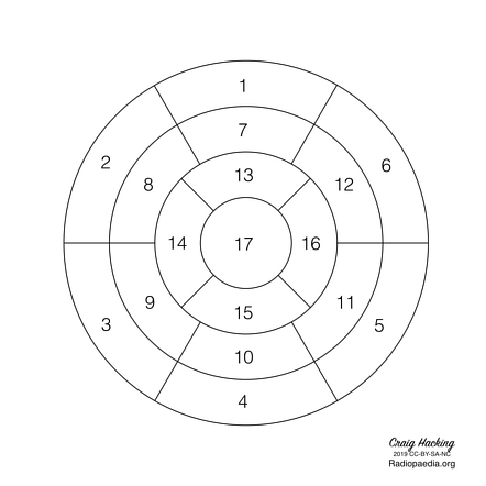 Left ventricular myocardial segments (diagram) | Image | Radiopaedia.org
