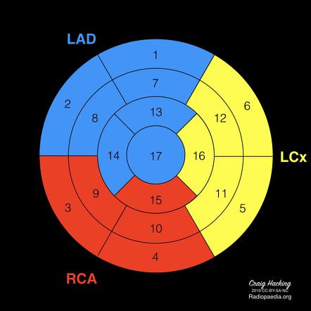 Cardiac Segmentation Model Radiology Reference Article Radiopaedia Org