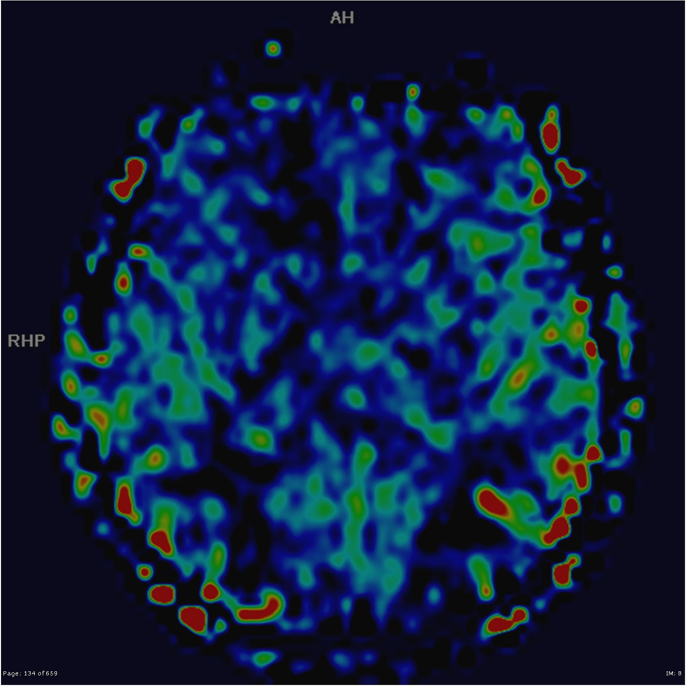 Image | Radiopaedia.org