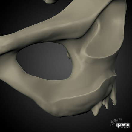 Enthesophyte | Radiology Reference Article | Radiopaedia.org