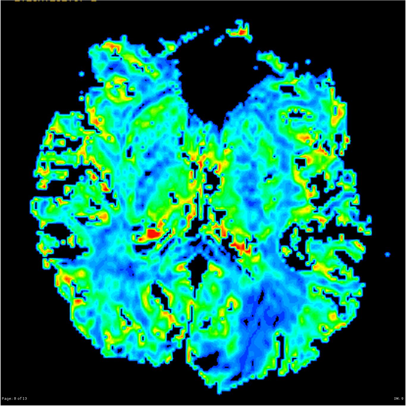 Image | Radiopaedia.org