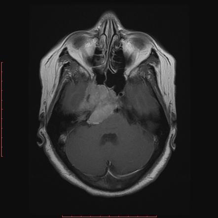 Radiology Quiz 25850 | Radiopaedia.org