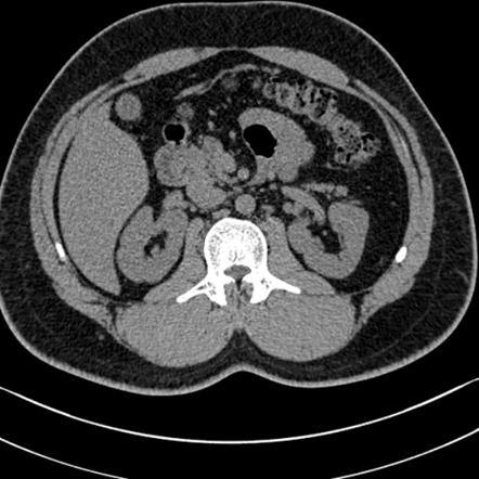 Playlist 'Anatomy' by dr sameh saad