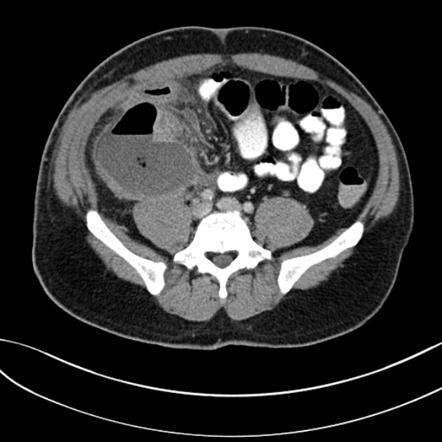 Playlist 'The Surgical Abdomen' by Dr Ian Bickle