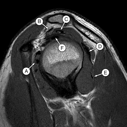 Images for MCQs | Image | Radiopaedia.org