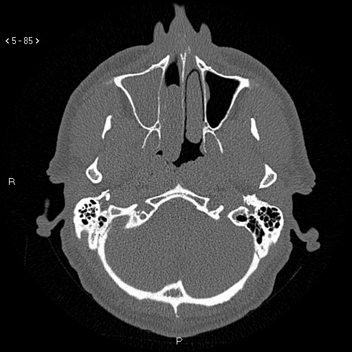 Image | Radiopaedia.org