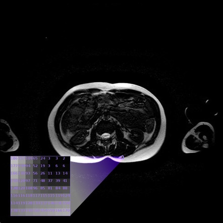 Digital Image Radiology Reference Article Radiopaedia Org