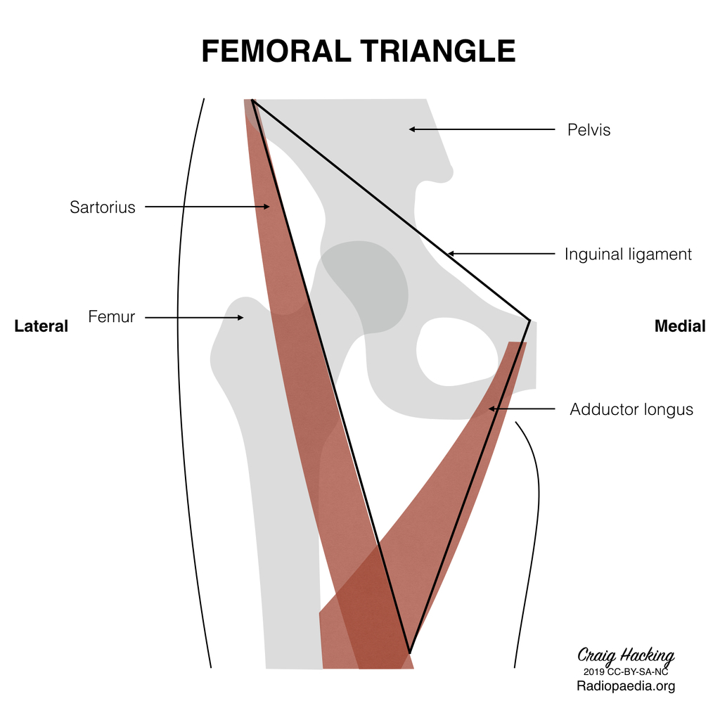 Femoral triangle (diagram) | Radiology Case | Radiopaedia.org