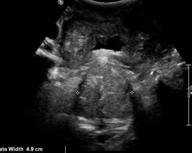 Radiology Quiz 71425 | Radiopaedia.org