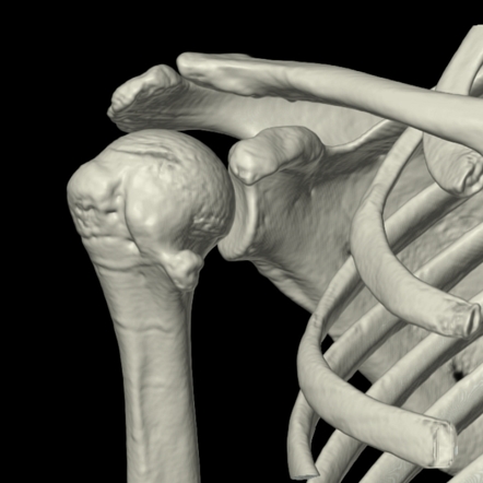 icd 10 code for osteochondroma humerus