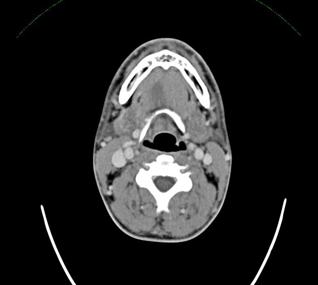 Radiology Quiz 71734 | Radiopaedia.org