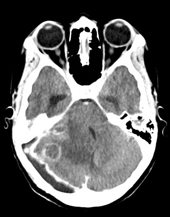 Playlist 'A rough night on call: abdominal CT in the ED' by Dr Michael ...