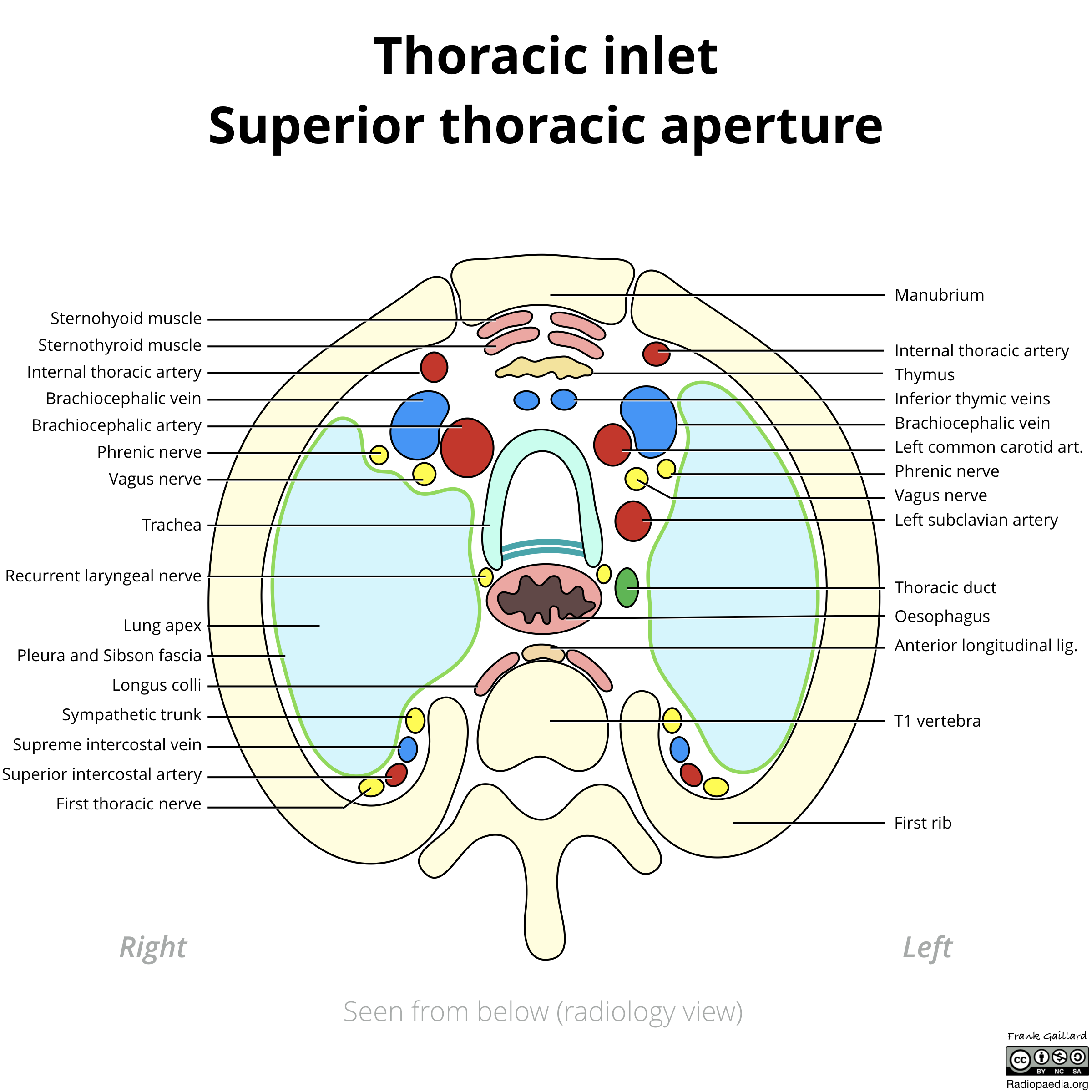 Apertura thoracis superior. Thoracic Inlet. Апертура Супериор. Superior Thoracic aperture. Манубриум.