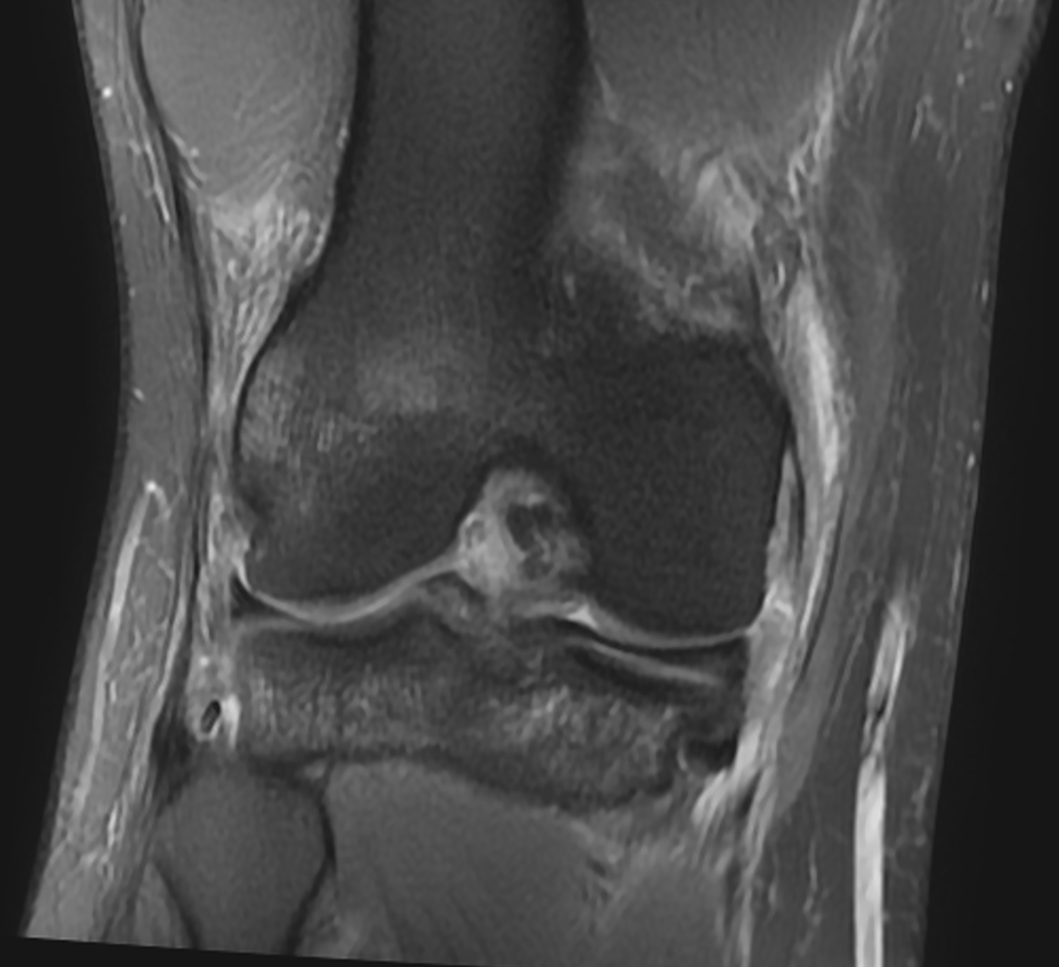 Radiology Quiz 72106 | Radiopaedia.org