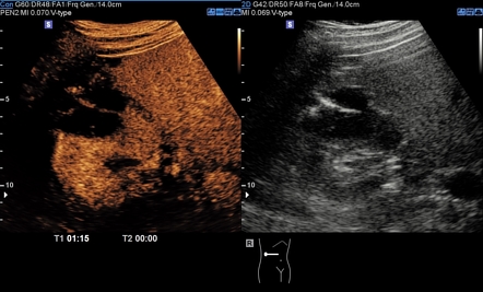 Radiology Quiz 72117 | Radiopaedia.org