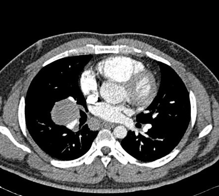 Images for MCQs | Image | Radiopaedia.org