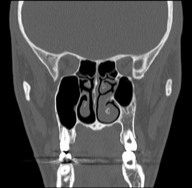 Radiology Quiz 73462 | Radiopaedia.org