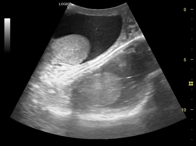  Ultrasound Physics Scanning AND Modes M Mode  6b8165cf2f2da910b7891b77e00cd8_big_gallery