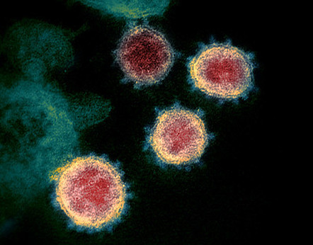 pneumonia virus structure