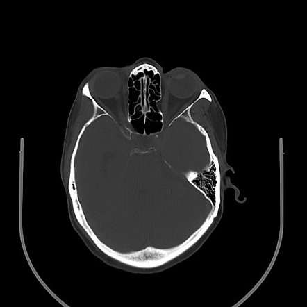 Image | Radiopaedia.org