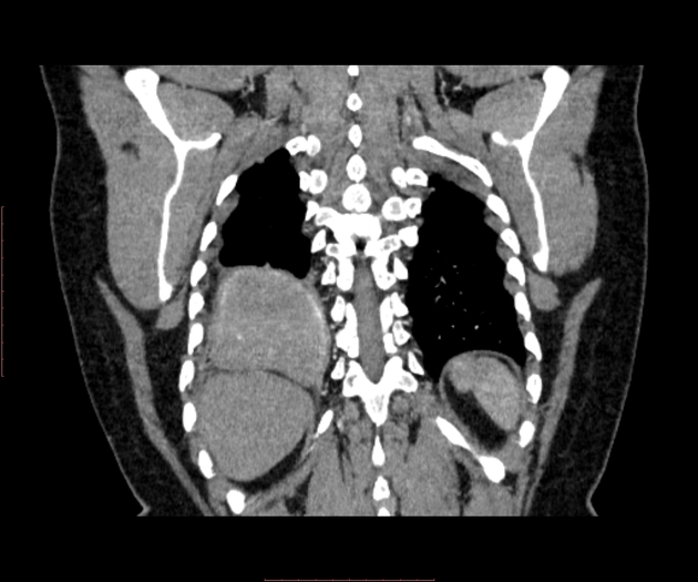 Images | Radiopaedia.org