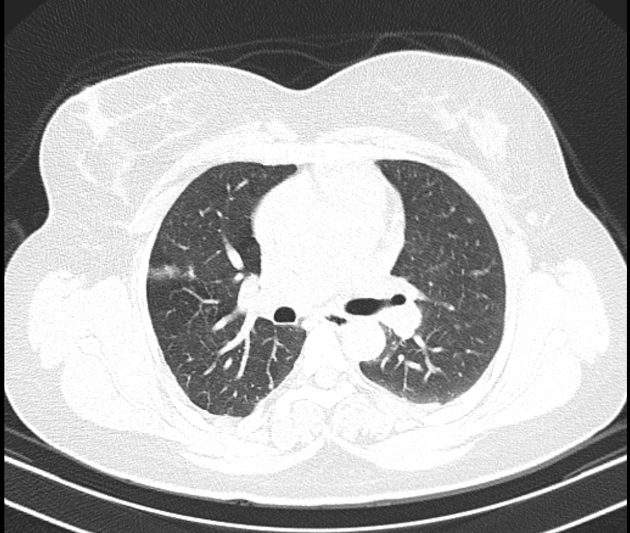 Images | Radiopaedia.org