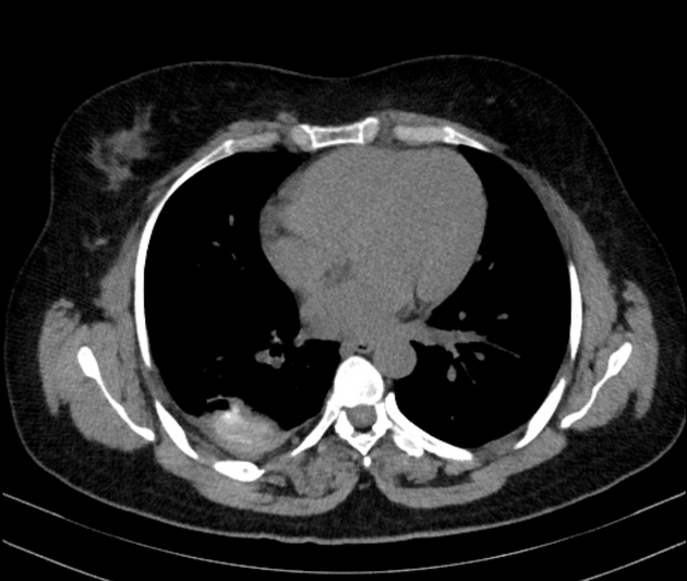 Images | Radiopaedia.org