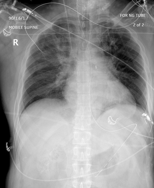 File:Aortopulmonary Wikipedia, 54% OFF