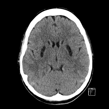 Radiology Quiz 75583 