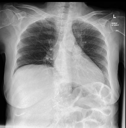 Radiology Quiz 75637 | Radiopaedia.org