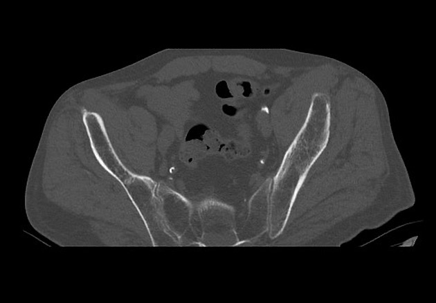 Radiology Quiz 75870 | Radiopaedia.org