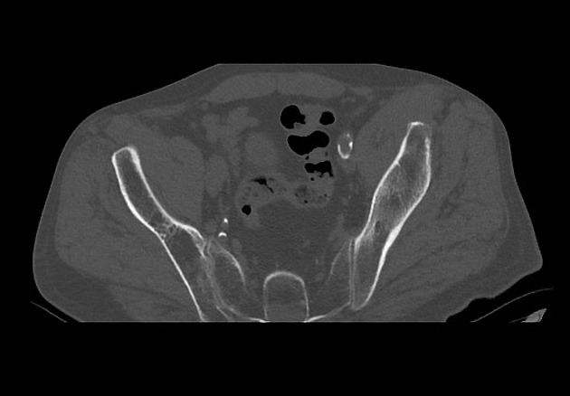 Radiology Quiz 75870 | Radiopaedia.org