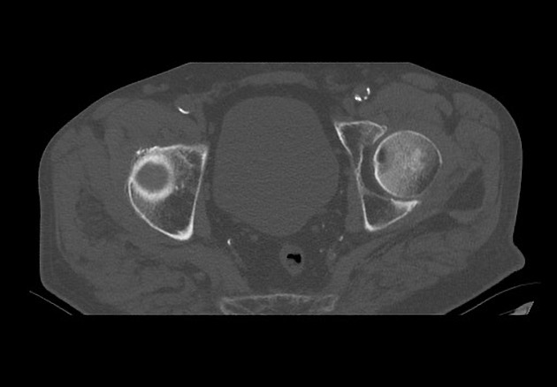 Radiology Quiz 75870 | Radiopaedia.org