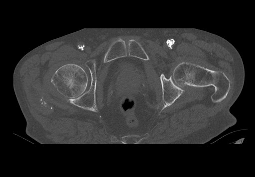 Radiology Quiz 75870 | Radiopaedia.org