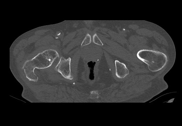 Radiology Quiz 75870 | Radiopaedia.org