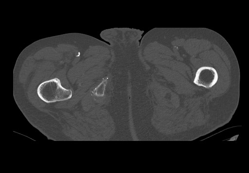 Radiology Quiz 75870 | Radiopaedia.org