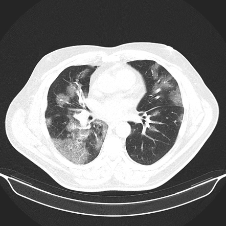 Radiology Quiz 76015 | Radiopaedia.org