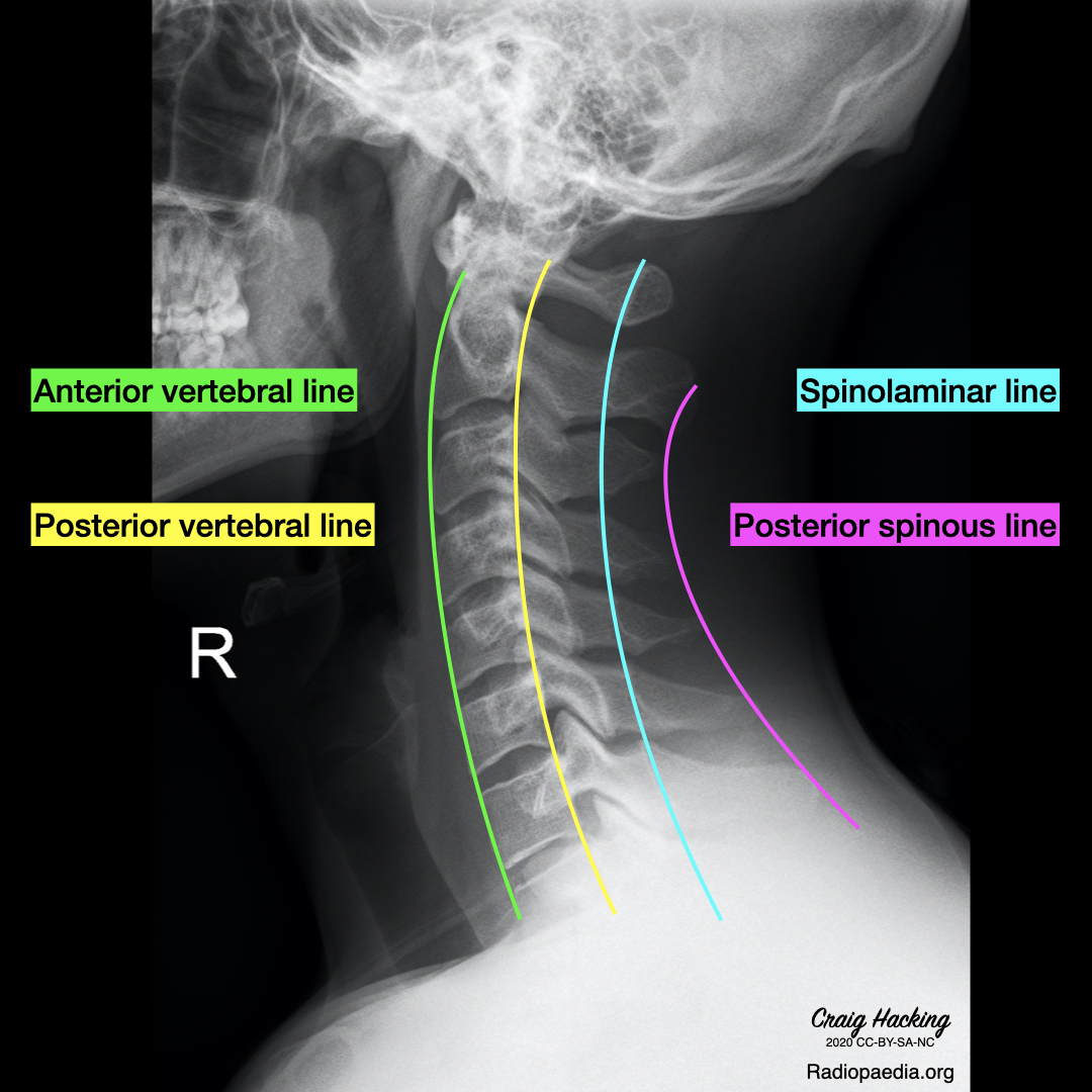 Image | Radiopaedia.org