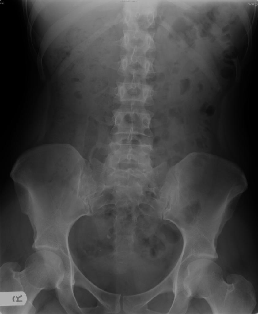 Radiology Quiz 10229 | Radiopaedia.org