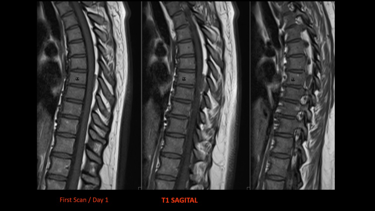 Image Radiopaedia Org