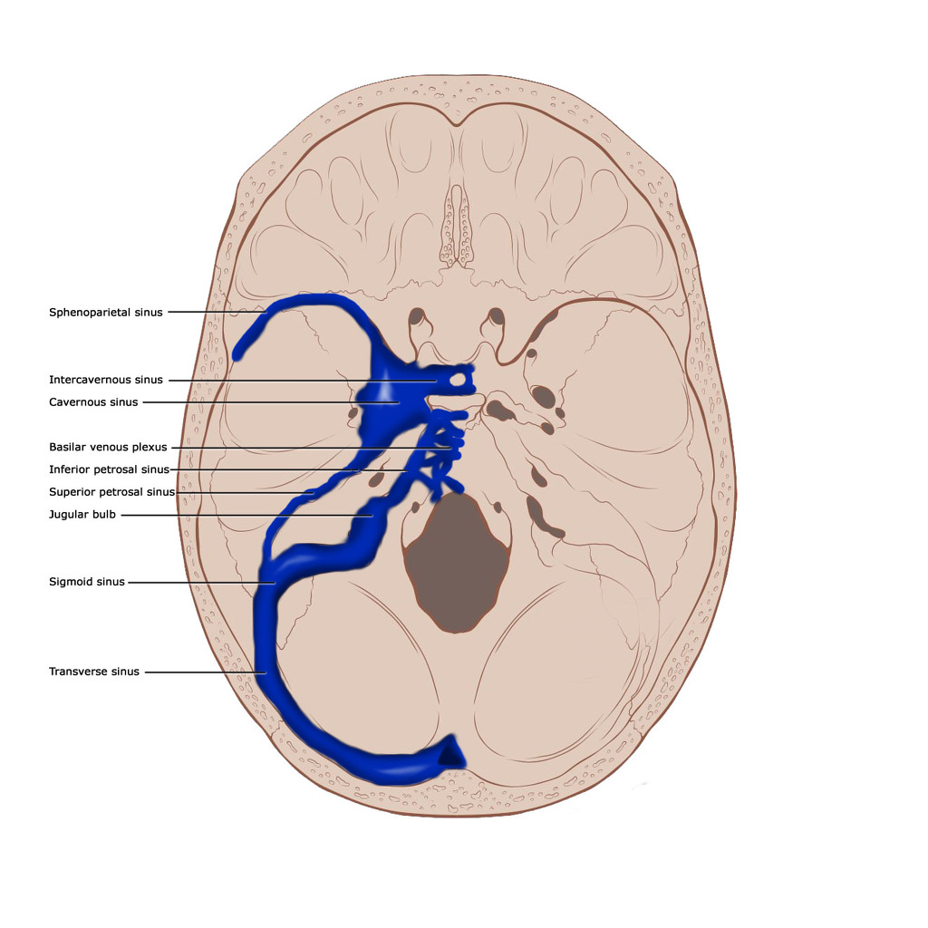 Dural Venous Sinuses Illustration Radiology Case Radiopaedia Org