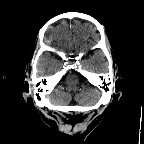 Radiology Quiz 76471 | Radiopaedia.org