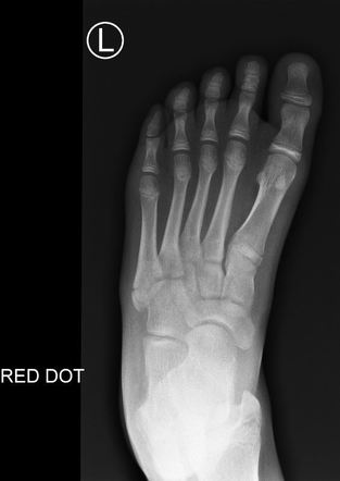 Radiographer abnormality detection system | Radiology Reference Article ...