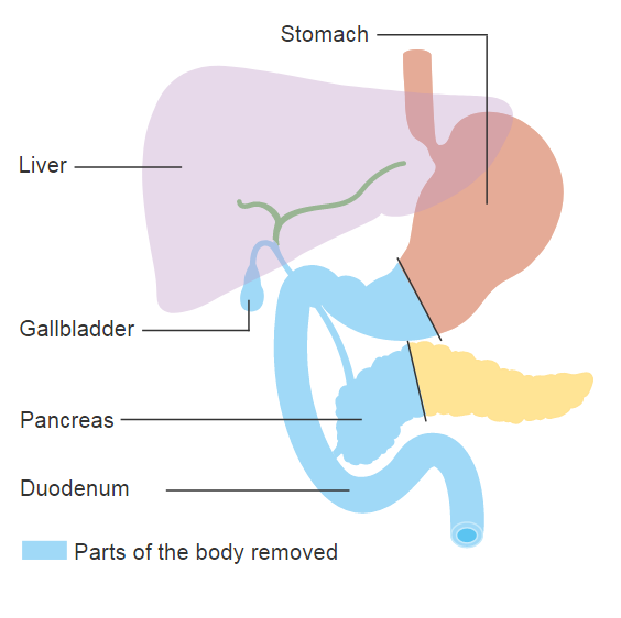 Images | Radiopaedia.org