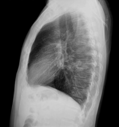 Malakoplakia with multisystem involvement | Image | Radiopaedia.org