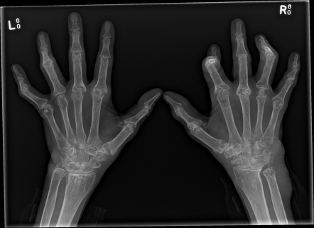 Radiology Quiz 78490 | Radiopaedia.org