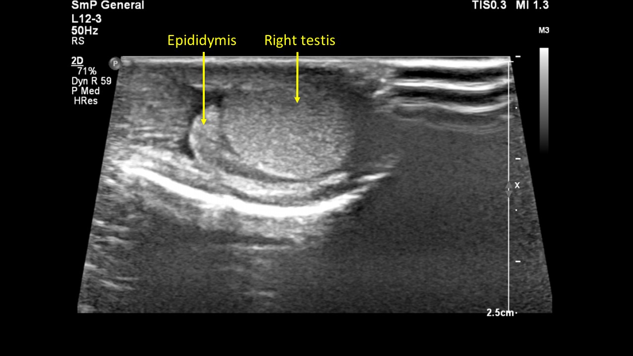 Image | Radiopaedia.org