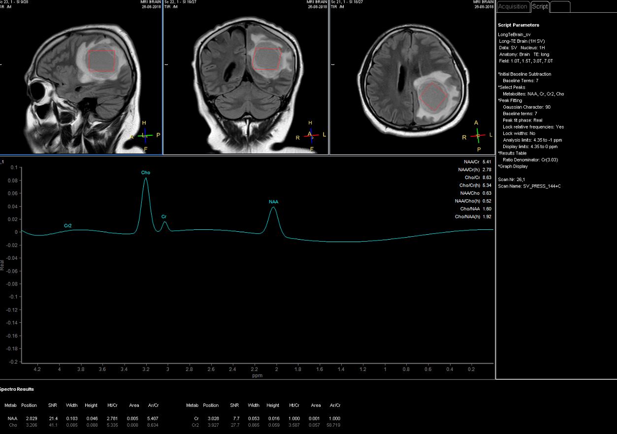 Image | Radiopaedia.org