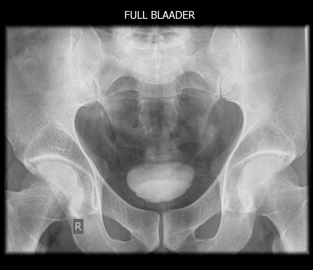 Radiology Quiz 78973 | Radiopaedia.org